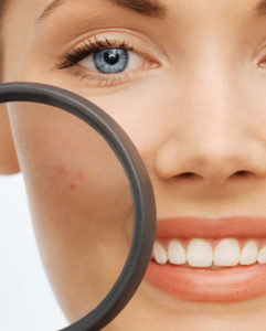 Ksantelazme Ksantelazme