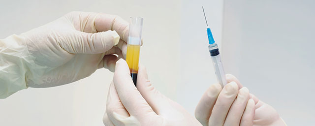 regenerativne terapije regenerativne terapije