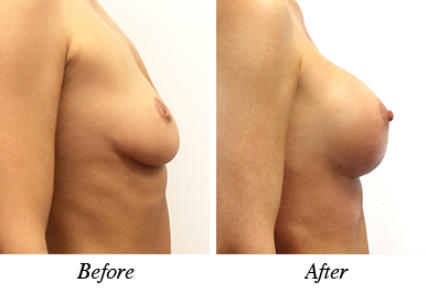 Patient 21 - before and after intervention