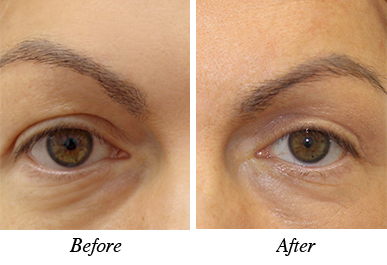 Patient 2 - Before and after intervention